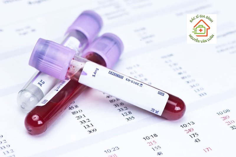 Ý nghĩa của các chỉ số xét nghiệm hóa sinh máu