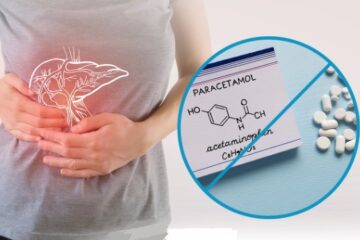 Phác đồ điều trị ngộ độc Paracetamol ở trẻ em – BV Nhi đồng 1